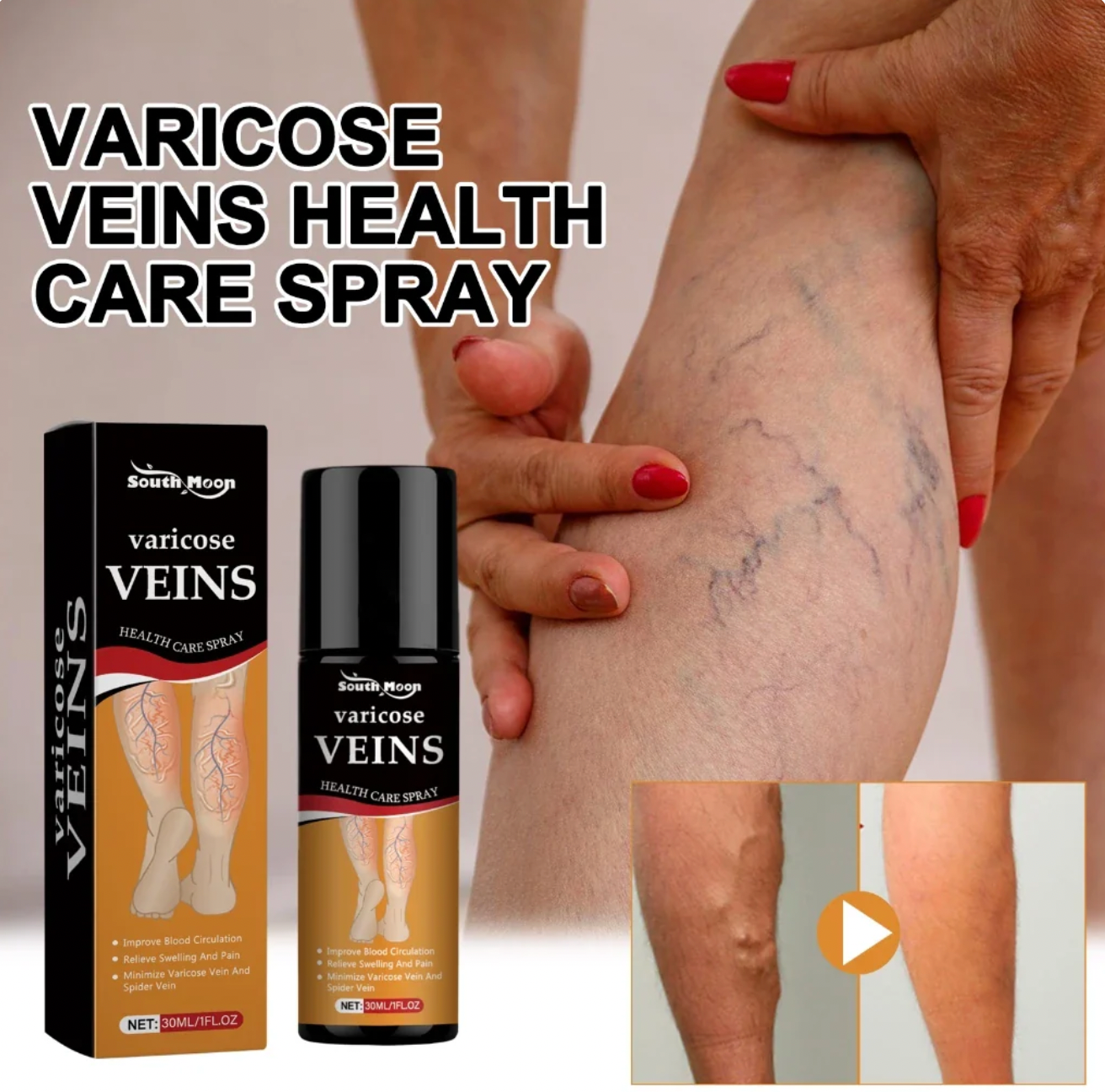 Turmeric Varicose Vein Relief Spray (BUY 1 GET 2 FREE 🎁)