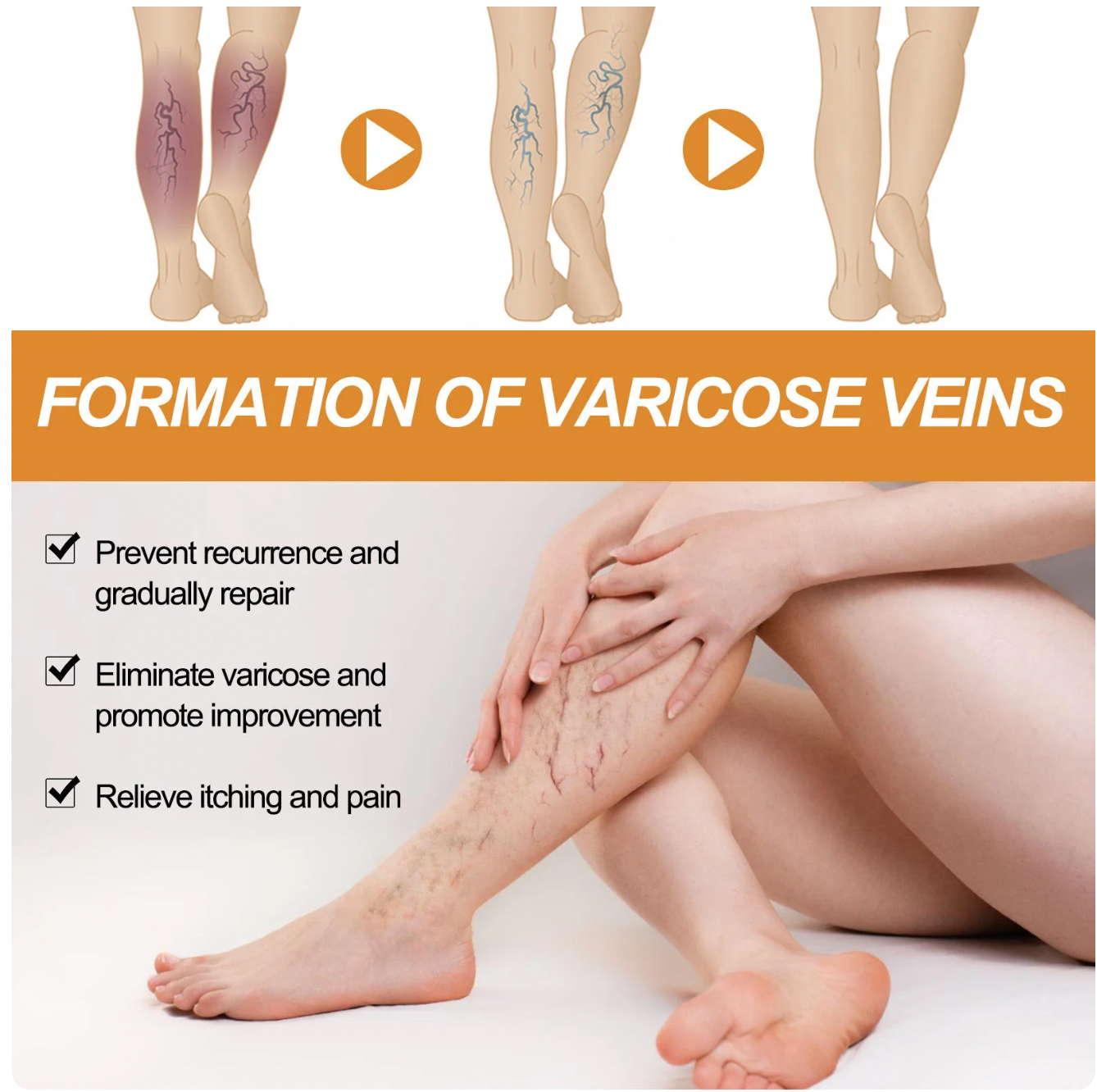 Turmeric Varicose Vein Relief Spray (BUY 1 GET 2 FREE 🎁)