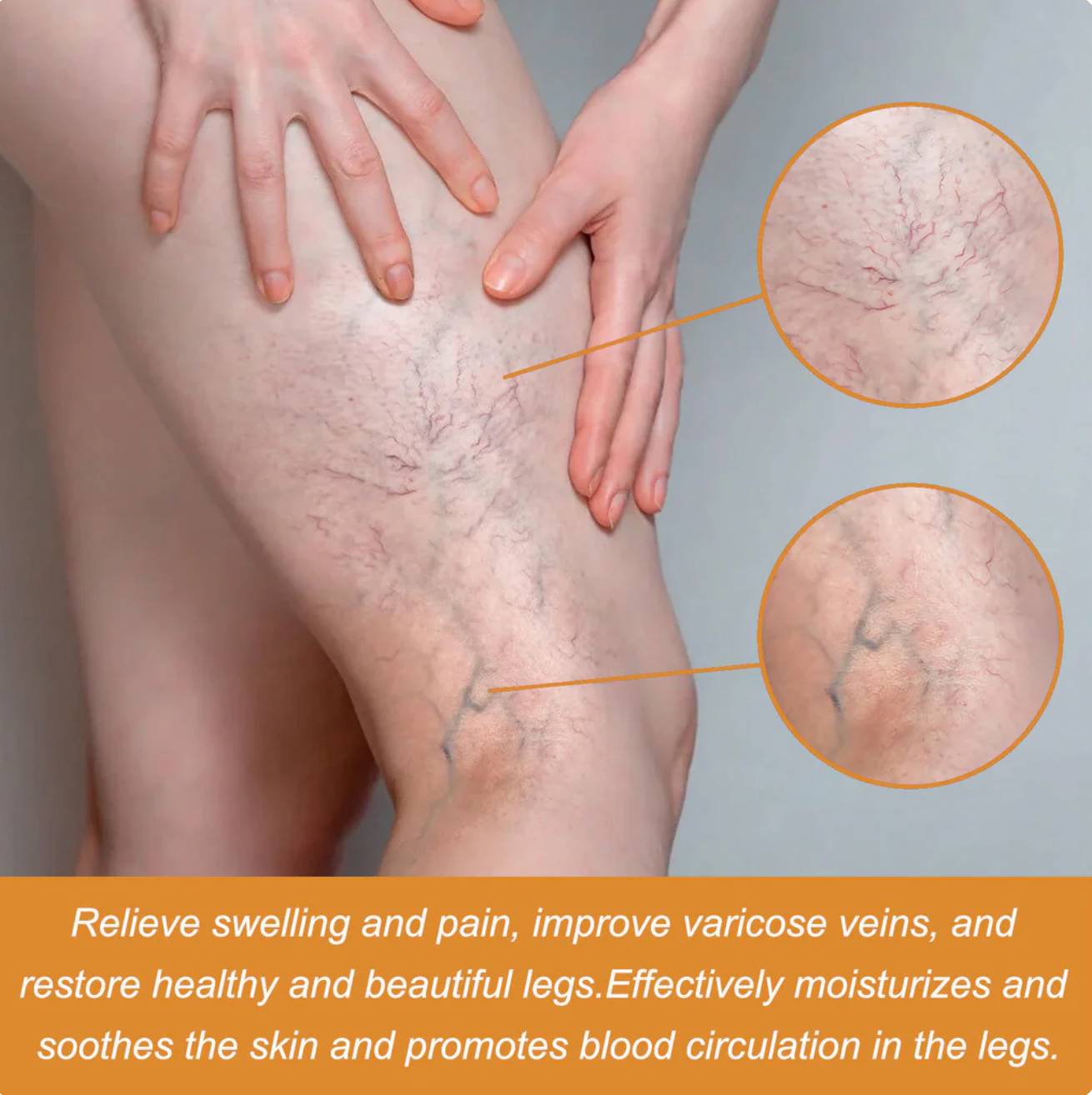 Turmeric Varicose Vein Relief Spray (BUY 1 GET 2 FREE 🎁)