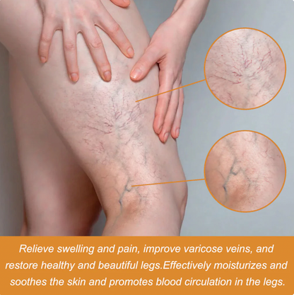 Turmeric Varicose Vein Relief Spray (BUY 1 GET 2 FREE 🎁)